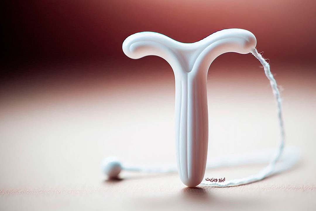 آی یو دی (IUD) |تیم علمی تحقیقاتی ایزوویزیت