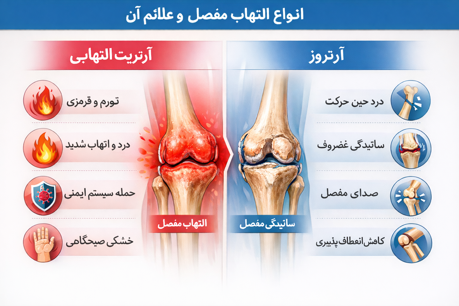 انواع التهاب مفاصل
