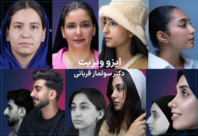 نمونه کارهای جراحی بینی دکتر سولماز قربانی