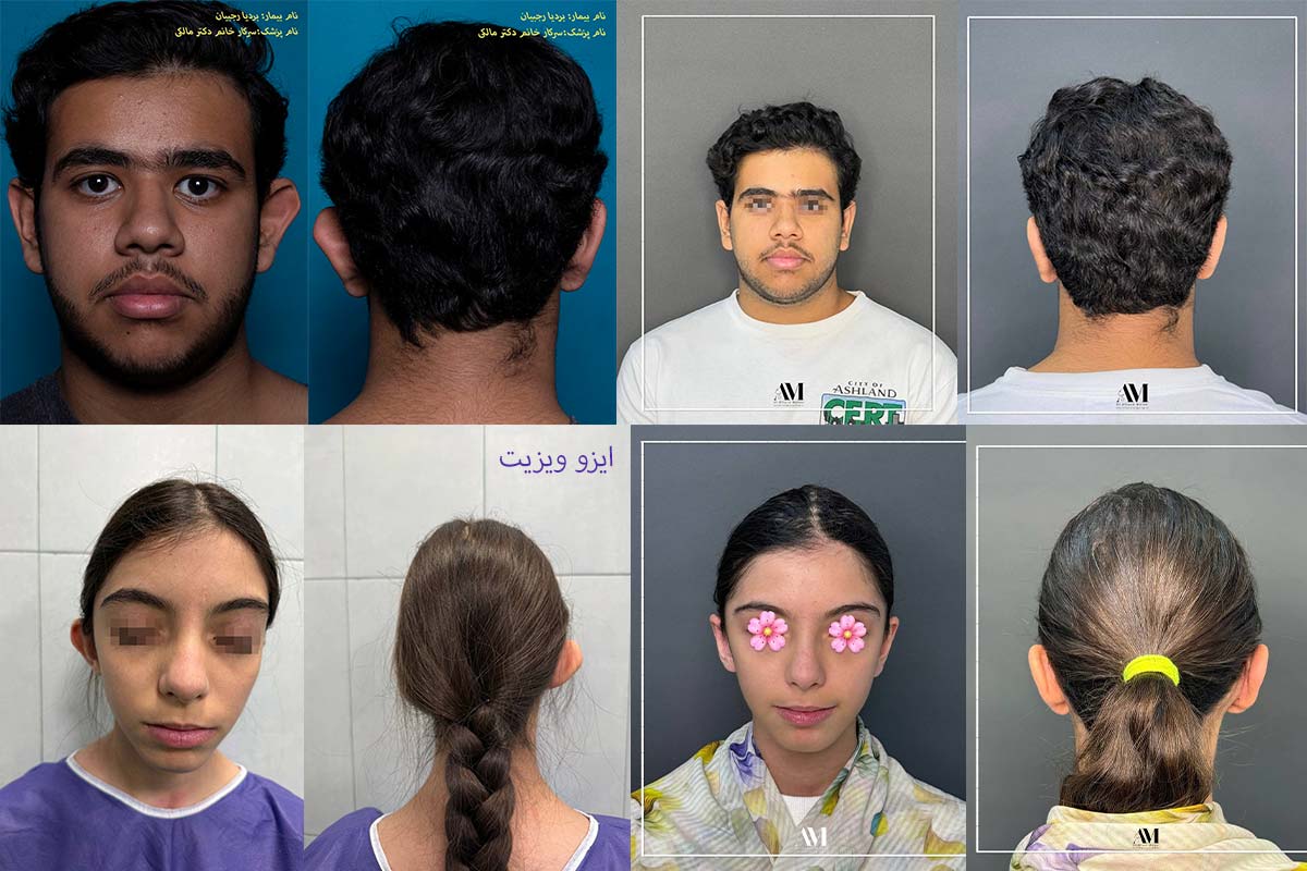 نمونه کار زیبایی گوش دکتر افسانه محمدپور مالکی