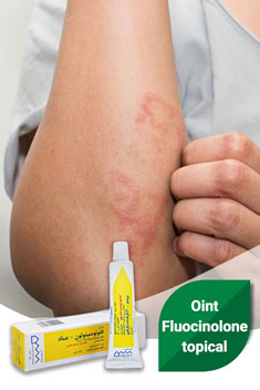 Oint Fluocinolone topical