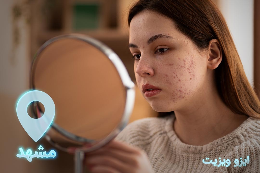 https://dl.isovisit.com/isovisit/uploads/acne-treatment.jpg