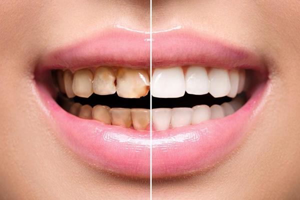 https://dl.isovisit.com/isovisit/uploads/best-laminate-dentists-mashhad_1792406033.jpg