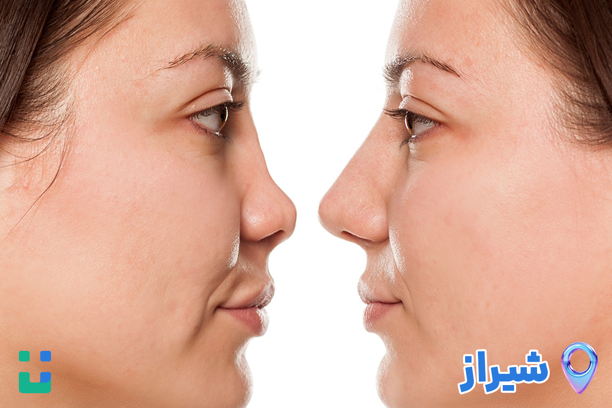 https://dl.isovisit.com/isovisit/uploads/best_revision_rhinoplasty_surgeon_shiraz_isovisit_online_doctor_1793163132.jpg