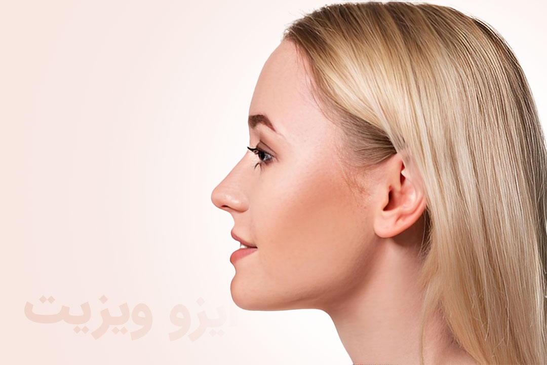 https://dl.isovisit.com/isovisit/uploads/complications-of-bone-rhinoplasty.jpg