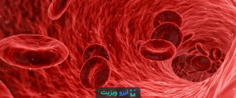 کمبود آهن و فقر آهن یکی از دلایل اصلی و قابل درمان ریزش موی منتشر و ضعیف شدن تارهای مو است.