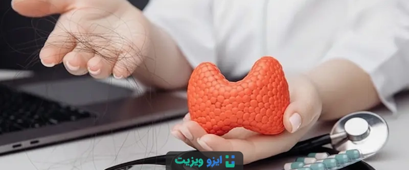 اختلالات تیروئید (اعم از کم&zwnj;کاری و پرکاری) با بر هم زدن تعادل هورمونی و چرخه رشد مو، باعث ریزش موی منتشر و پراکنده می&zwnj;شوند
