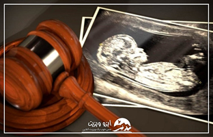 مجازات سنگین برای سقط جنین غیرقانونی در ایران