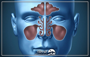 سینوزیت یکی از بیماری‌های رایج در سرماخوردگی و آنفولانزا است.