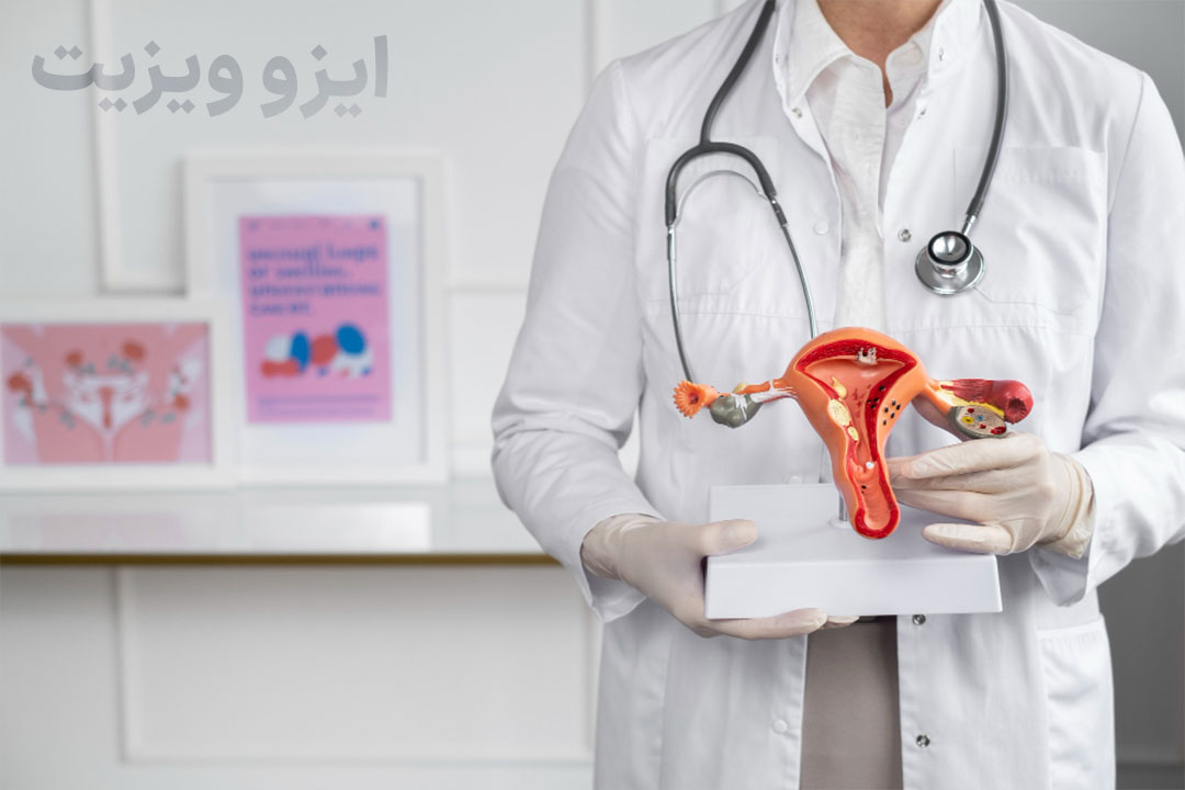 https://dl.isovisit.com/isovisit/uploads/pcos1.jpg