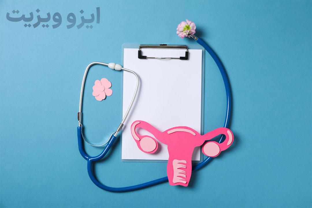 درمان PCOS یا سندرم تخمدان پلی کیستیک