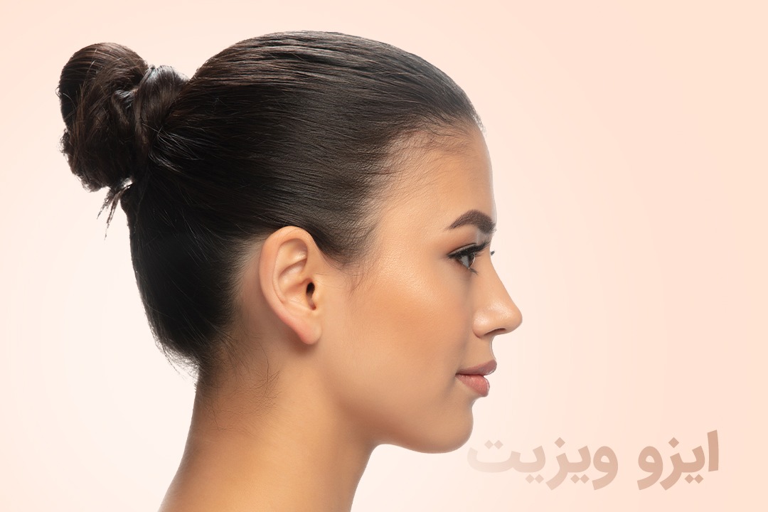 https://dl.isovisit.com/isovisit/uploads/rhinoplasty-cost-in-shiraz2.jpg