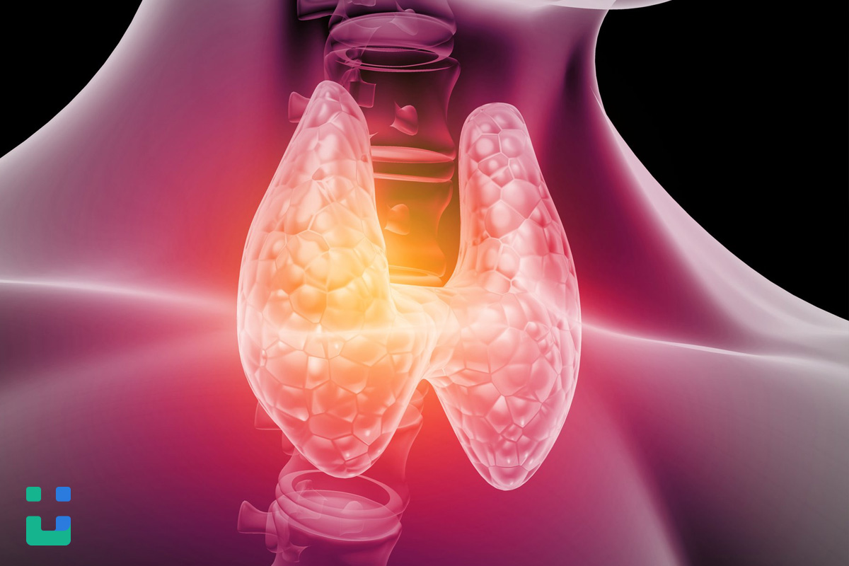 https://dl.isovisit.com/isovisit/uploads/ti-rads-thyroid-ultrasound-isovisit-online-doctor_1792560705.jpg