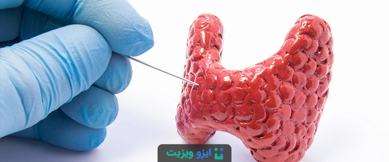 نمونه برداری تیروئید یا FNA