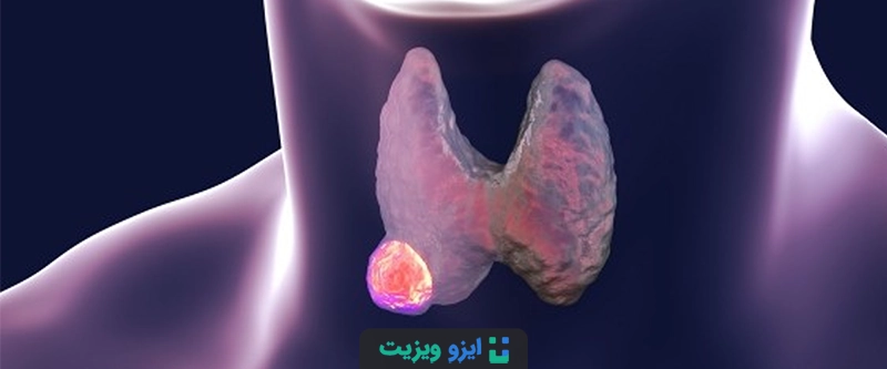 TI-RADS مخفف عبارت Thyroid Imaging Reporting and Data System به معنای &laquo;سیستم گزارش&zwnj;دهی و داده&zwnj;های تصویربرداری تیروئید&raquo; است.