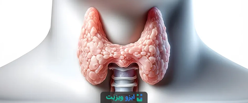 زمان مناسب نمونه برداری؟ در سیستم ACR، تصمیم بر اساس ترکیب درجه ندول و اندازه آن گرفته می&zwnj;شود.