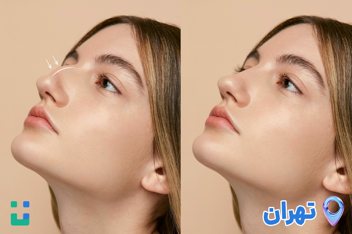 https://dl.isovisit.com/isovisit/uploads/top-rhinoplasty-surgeon-tehran-isovisit-online-doctor_1793087201.jpg