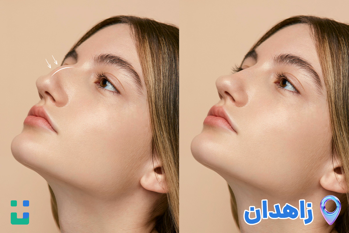 بهترین دکتر عمل بینی در زاهدان | معرفی 5 جراح برتر |تیم علمی تحقیقاتی ایزوویزیت