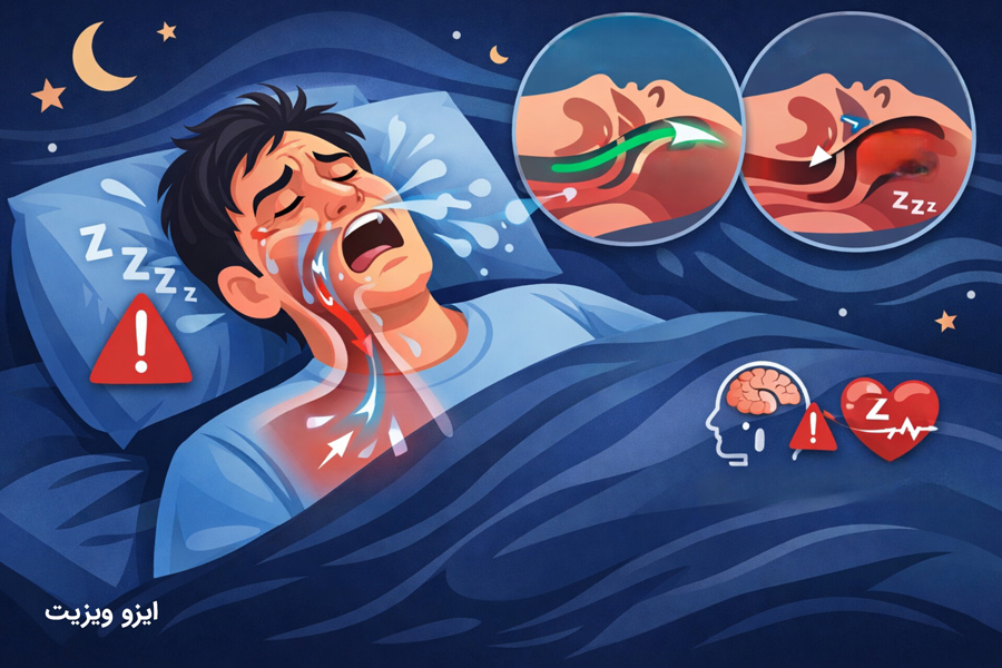 علائم آپنه خواب